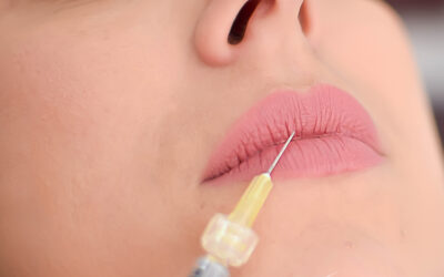 Preenchimento labial: Você tem medo de fazer?