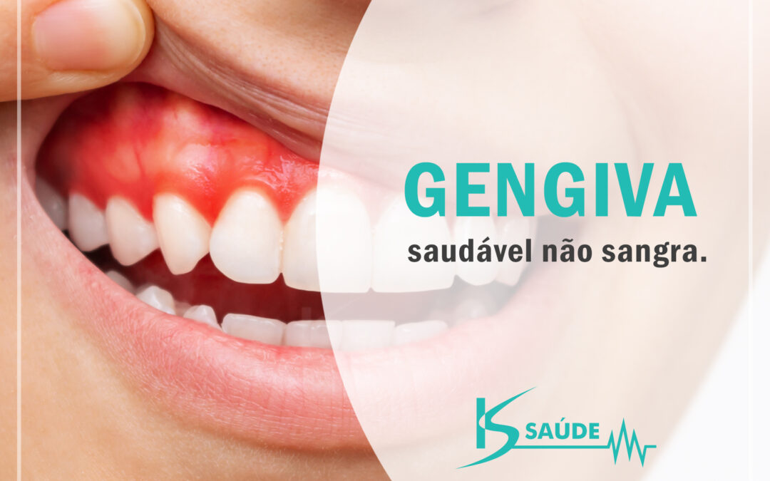 Gengiva Saudável não sangra, sabia?