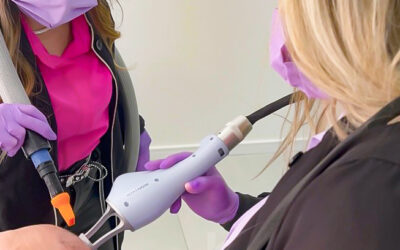 Benefícios do Laser Lavieen no tratamento capilar