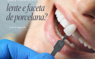 Qual a diferença entre lentes e facetas de porcelana ?