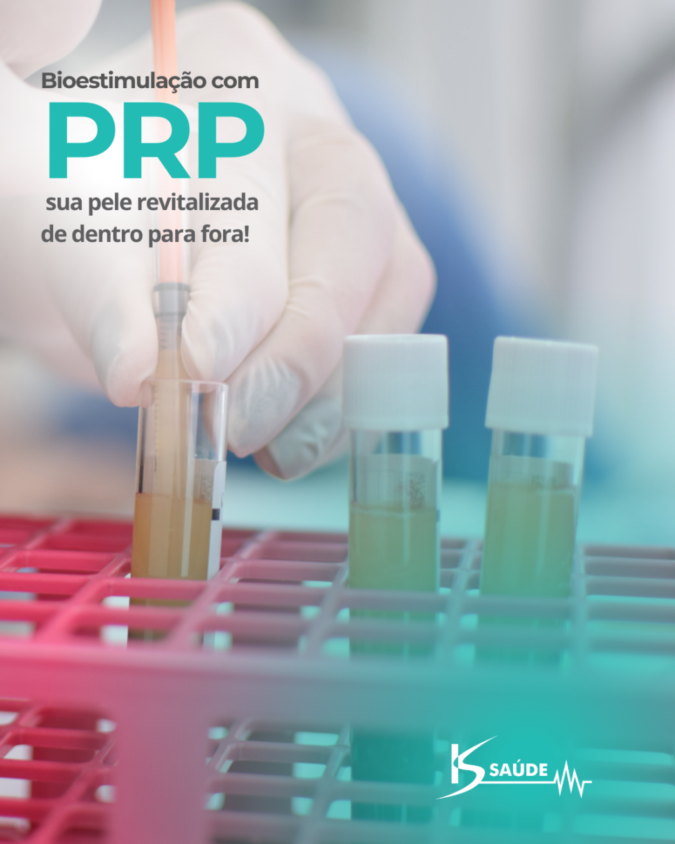 Tudo sobre PRP: Sua pele mais jovem e saudável com PRP! - kssaude.com.br