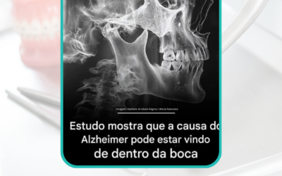 Alzheimer X Saúde Bucal: qual a relação?